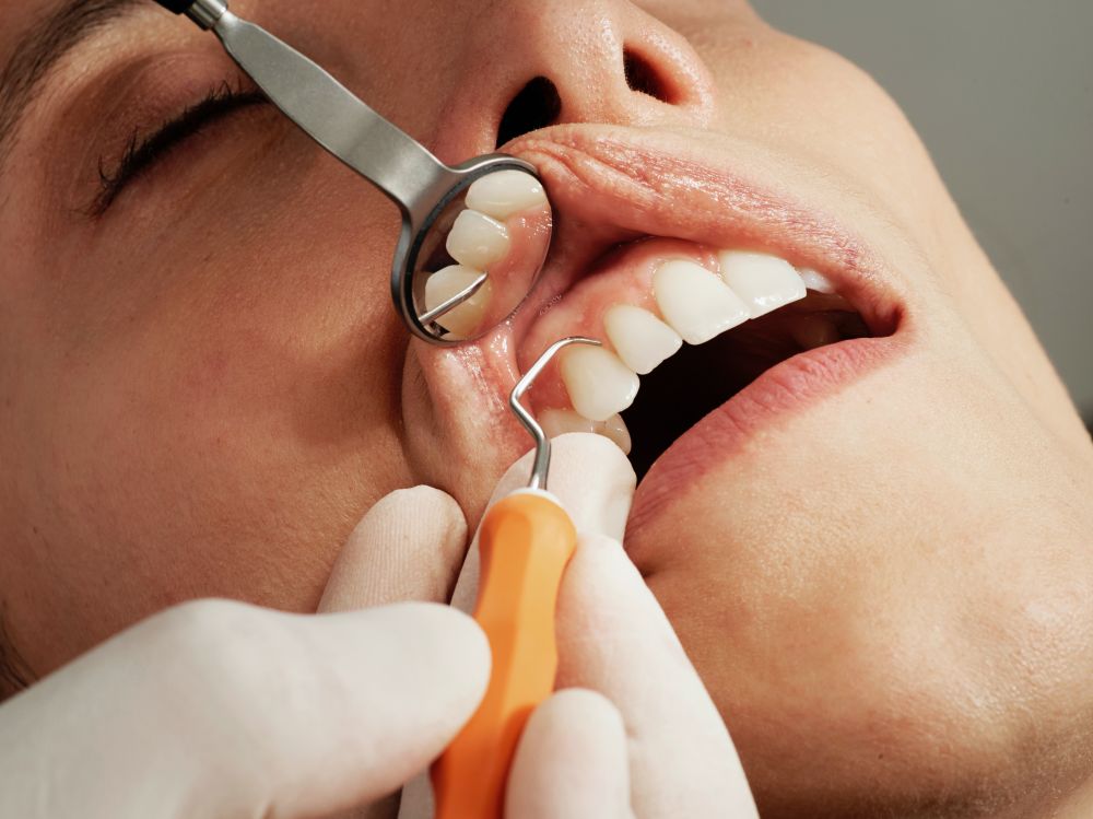 Lad din tandlæge holde dine tænder sunde og smukke